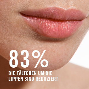 83 % sagen, dass die Fältchen um die Lippen reduziert wirken